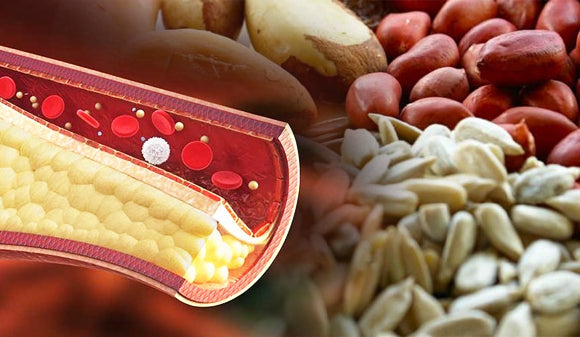 Fitoesteroles, ¿reducen el colesterol?